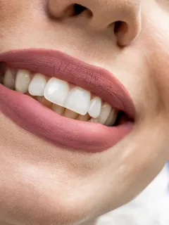 Primer plano de boca femenina con dientes blancos y saludables
